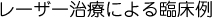 レ＝ザー治療による臨床例